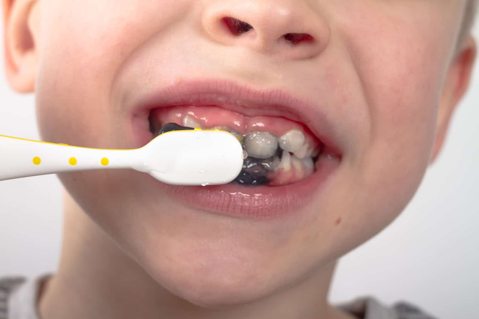 Caucasian boy brushes his teeth with black toothpaste with charcoal.