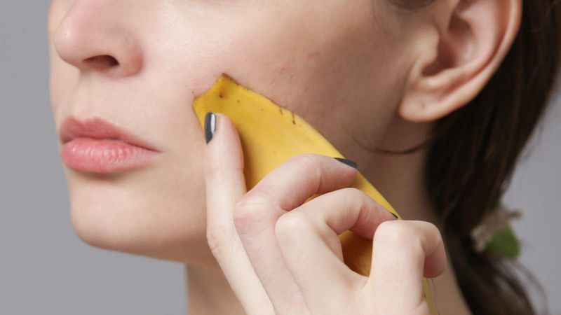 Banana Peel Acne Treatment