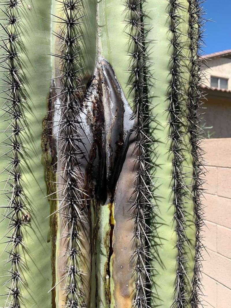 Bacterial Necrosis Is A Serious Warning Sign