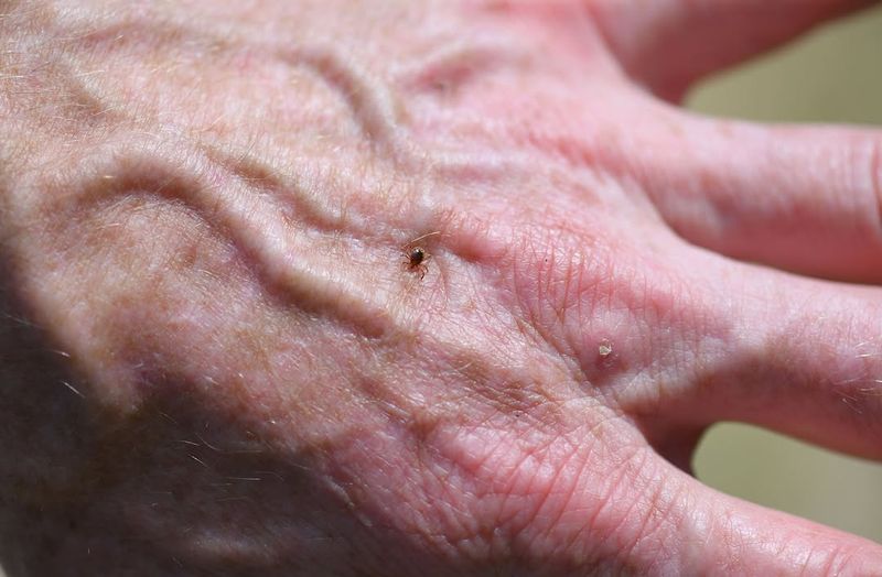 Check For Ticks After Yard Work