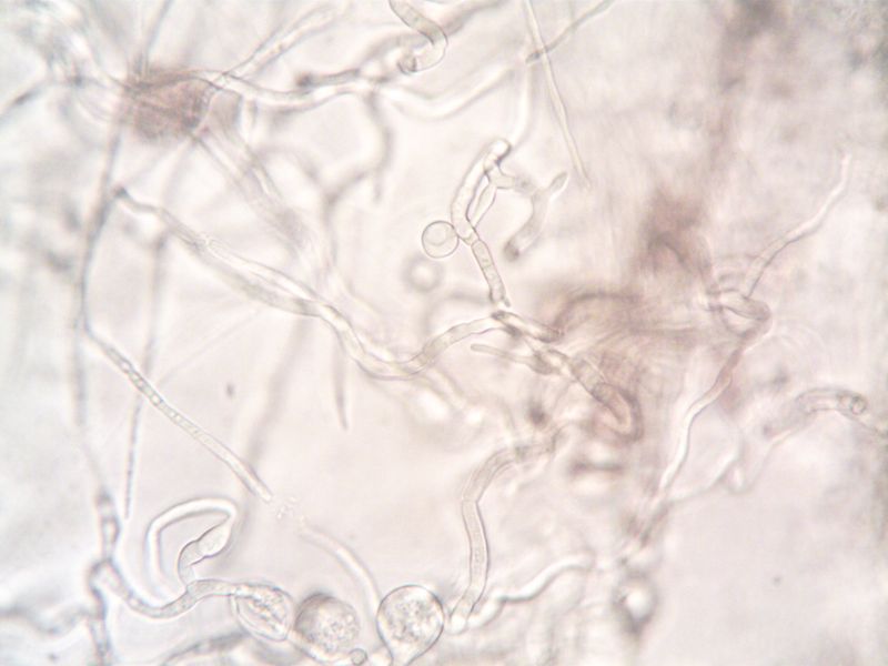Dormant Spores Wake Up When June Temps Rise Dormant Spores Wake Up When June Temps Rise