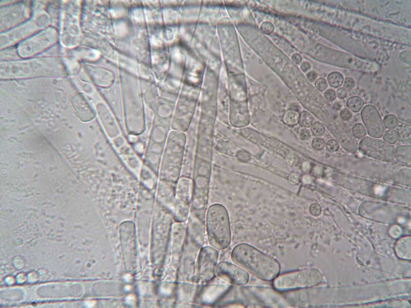 Milky Spore Bacteria Removes Grubs Naturally Over Time