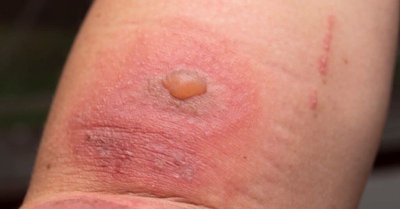 Touching Or Crushing Them Can Cause Skin Irritation Touching Or Crushing Them Can Cause Skin Irritation