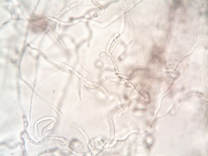 Use Milky Spore Or Beneficial Nematodes For Long-Term Protection Use Milky Spore Or Beneficial Nematodes For Long-Term Protection