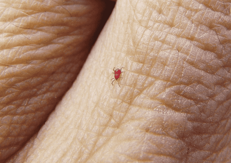 Know Chiggers Bite Fast But Do Not Stay Attached