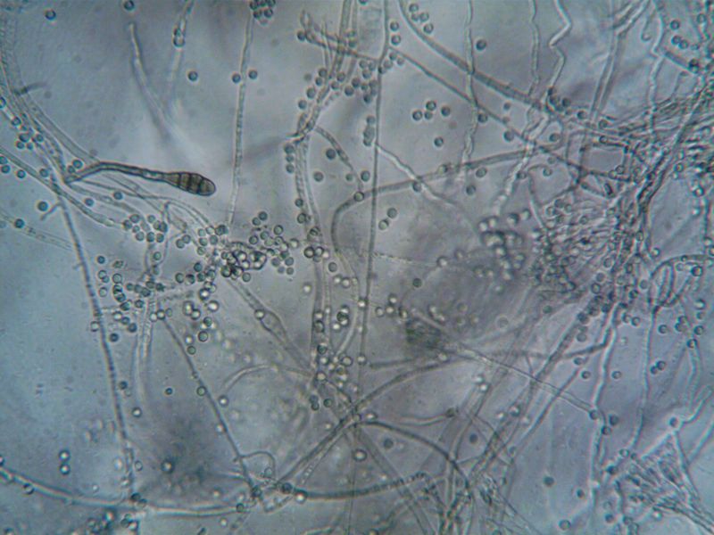 Daylight Fuels Faster Pathogen Growth Daylight Fuels Faster Pathogen Growth