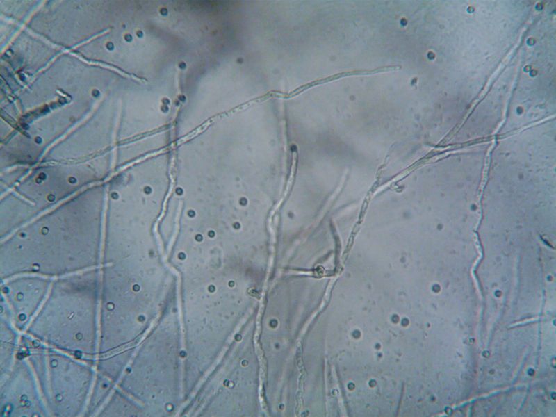 Fungal Growth Thrives In Humid, Cool Conditions