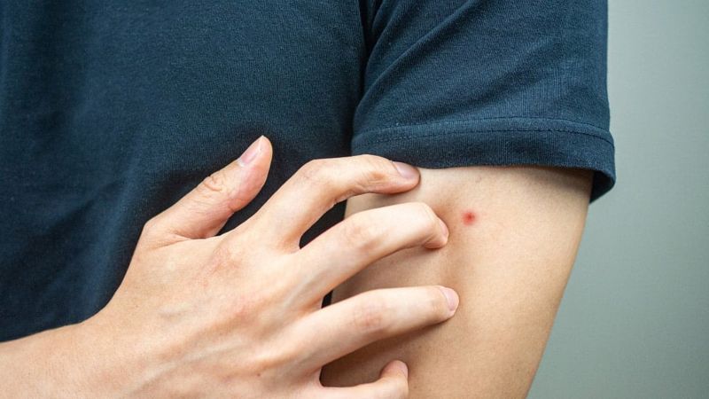 Muscle Cramps Can Be A Bigger Clue Than The Bite Mark