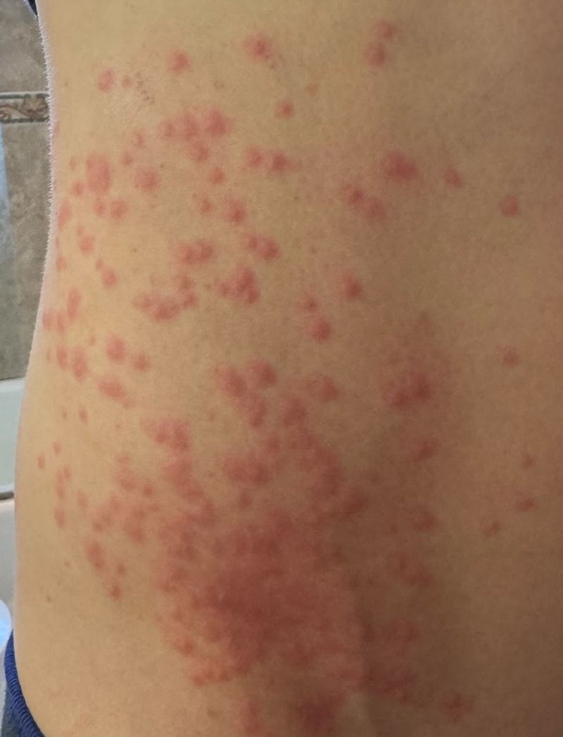 The Tufts That Can Leave Skin Itchy And Irritated The Tufts That Can Leave Skin Itchy And Irritated