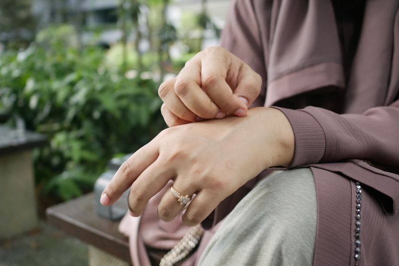 Common Mistakes That Spread The Rash Common Mistakes That Spread The Rash
