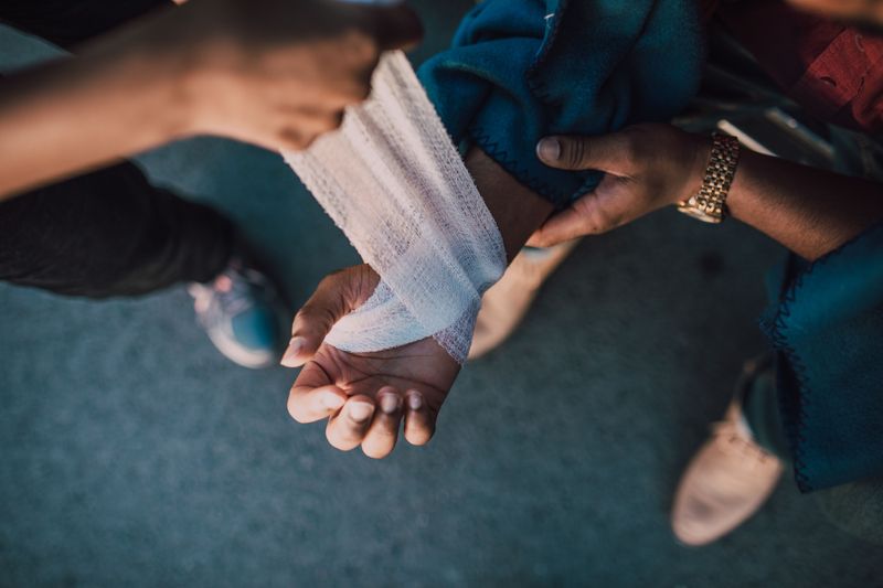 First Aid That Actually Helps After Contact First Aid That Actually Helps After Contact