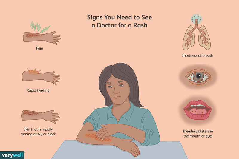 Know when a rash or other symptoms need medical care