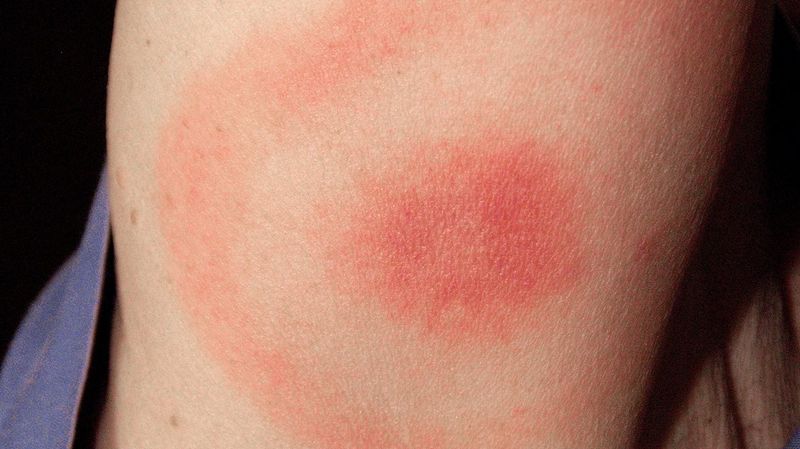 Know which symptoms need medical attention Know which symptoms need medical attention