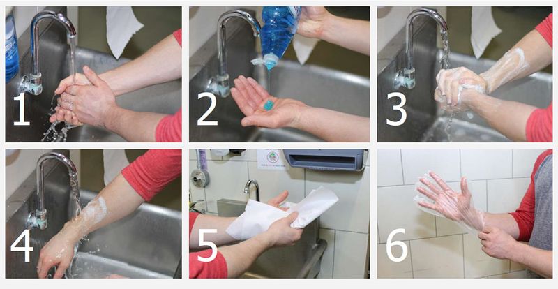 Wash exposed skin and contaminated items promptly