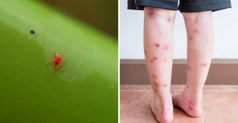 Those Itchy Fall Bites Could Be Chiggers Hiding In Your Virginia Yard