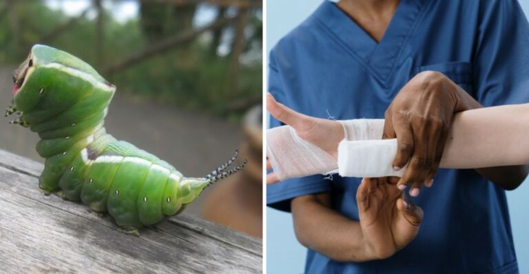 Louisiana Is Seeing A Fall Resurgence Of One Of North America’s Most Venomous Caterpillars