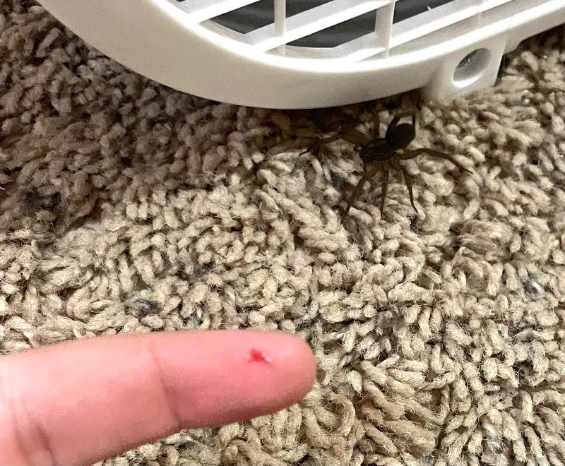 A Bite That Rarely Causes More Than Mild Pain