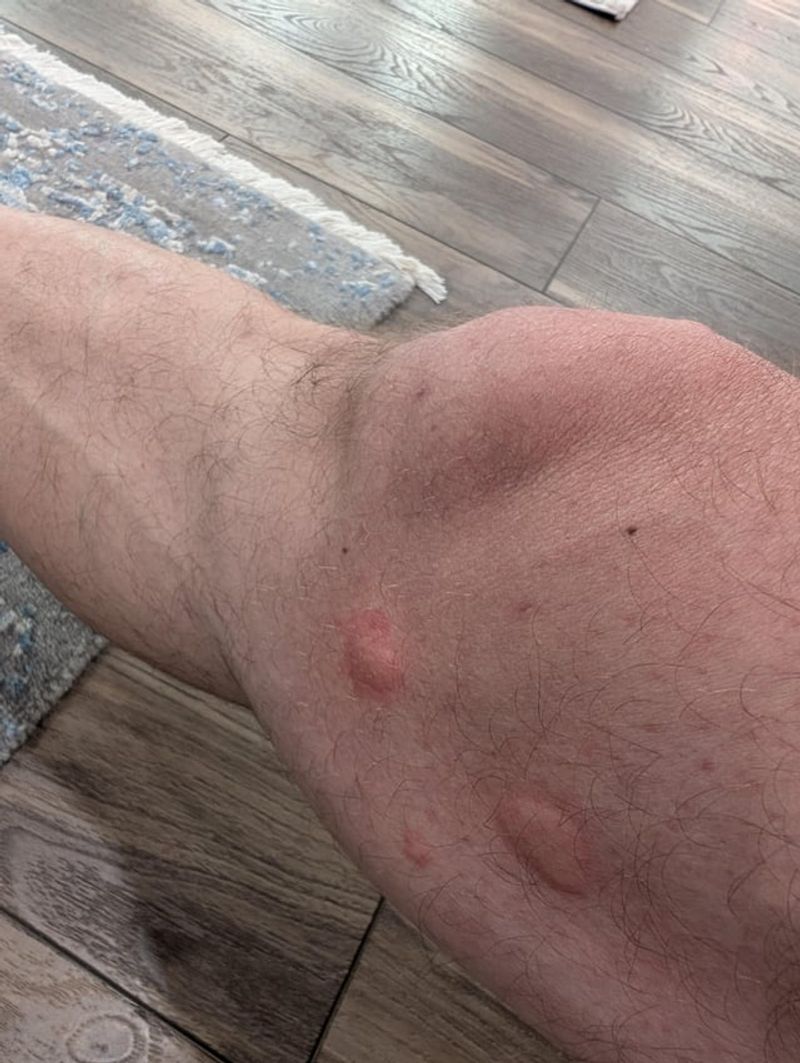 Its Sting Can Trigger Serious Allergic Reactions Its Sting Can Trigger Serious Allergic Reactions