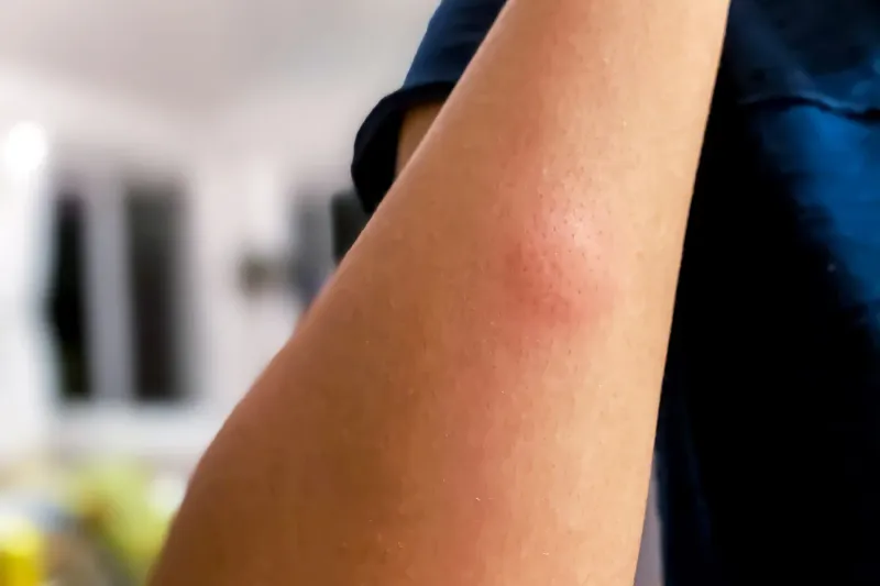 Mosquitoes remain possible