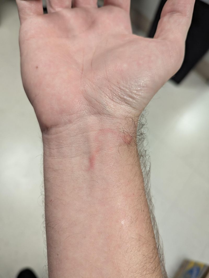 Their Stings Itch For Days Their Stings Itch For Days