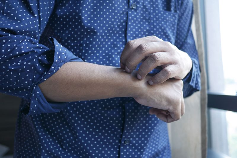 Treat The Itch Without Scratching