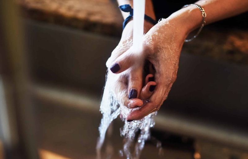 Wash The Sting With Soap And Water Wash The Sting With Soap And Water