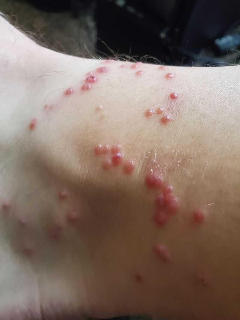 Watch For Signs Of Infection