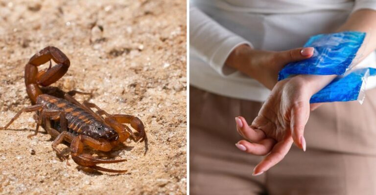 What To Do If You’re Stung By A Scorpion In Your Texas Garden