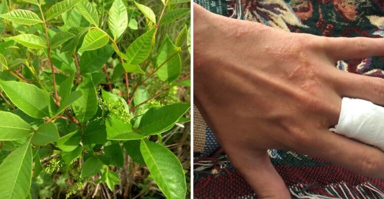 The Virginia Yard Shrub That’s Quieter Than A Copperhead But Just As Risky To Handle
