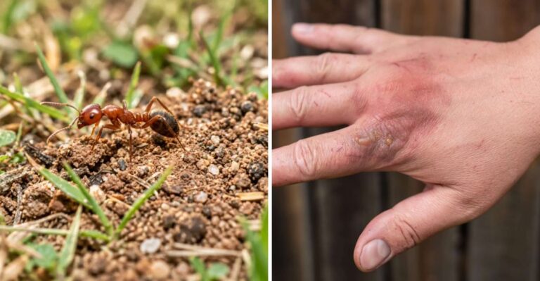 Stung By Fire Ants? What Texas Gardeners Should Do In The First Few Minutes
